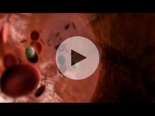 Doxil Cancer MOA
